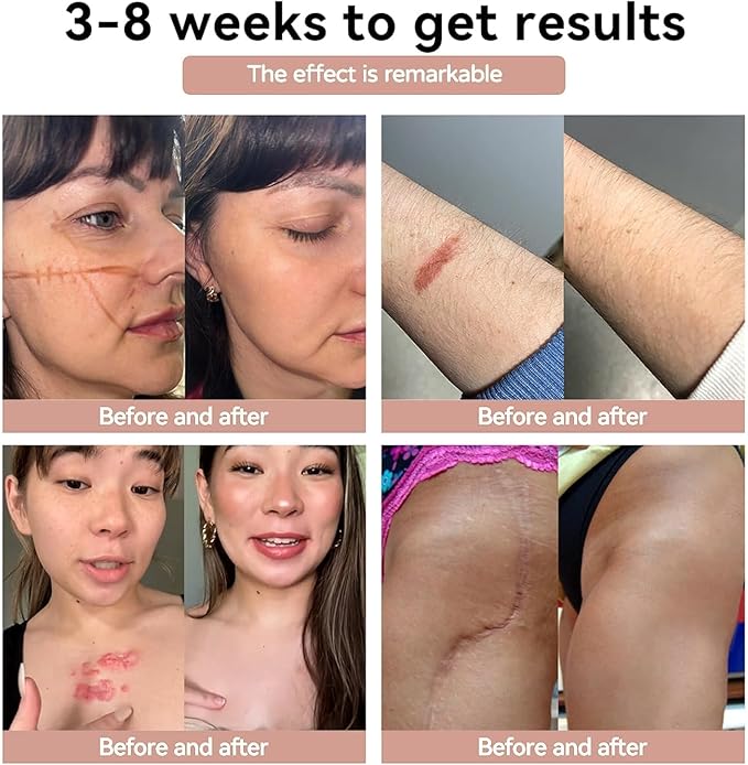 anti wrinkle and scar stick